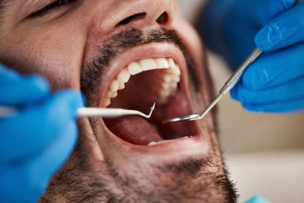 Best Emergency Root Canal Treatment in Kidron, OH