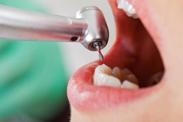 Best Urgent Care for Lost Fillings or Crowns in Kidron, OH
